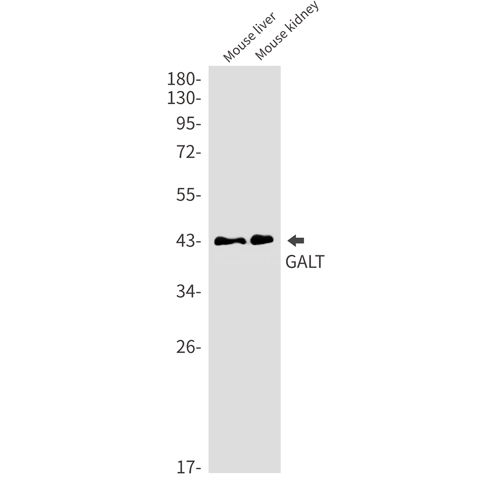 GALT Rabbit mAb ABZ3301