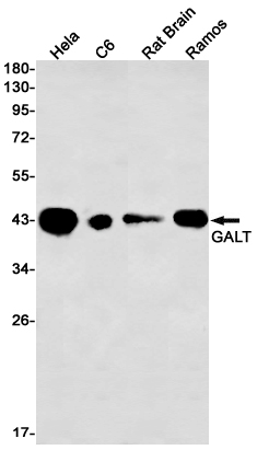 GALT Rabbit mAb ABZ3301