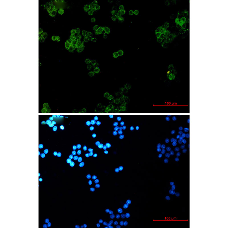 gamma Catenin Rabbit mAb ABZ3302