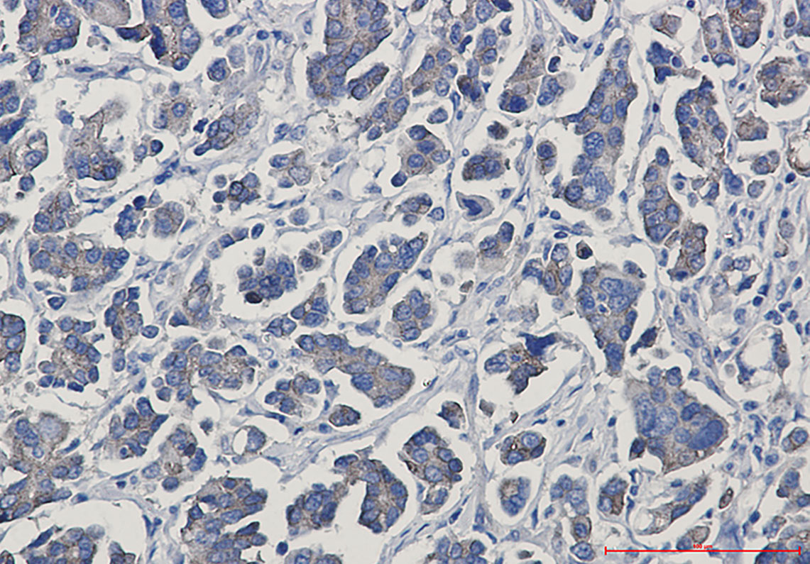 gamma Catenin Rabbit mAb ABZ3302