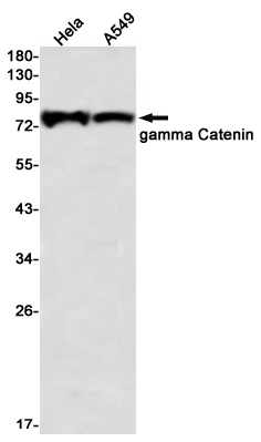 gamma Catenin Rabbit mAb ABZ3302