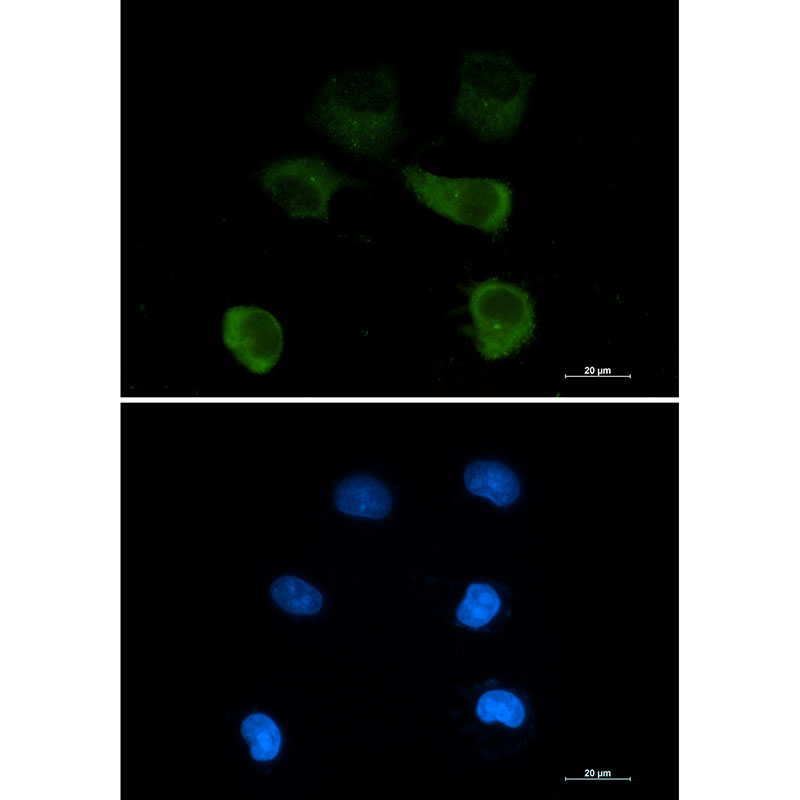 gamma Tubulin Rabbit mAb ABZ3303