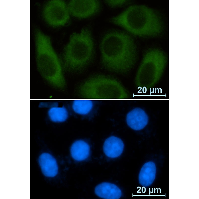 Glucose 6 Phosphate Dehydrogenase Rabbit mAb ABZ3304