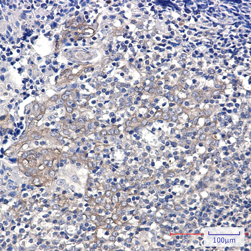 Glucose 6 Phosphate Dehydrogenase Rabbit mAb ABZ3304