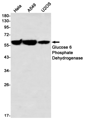 Glucose 6 Phosphate Dehydrogenase Rabbit mAb ABZ3304