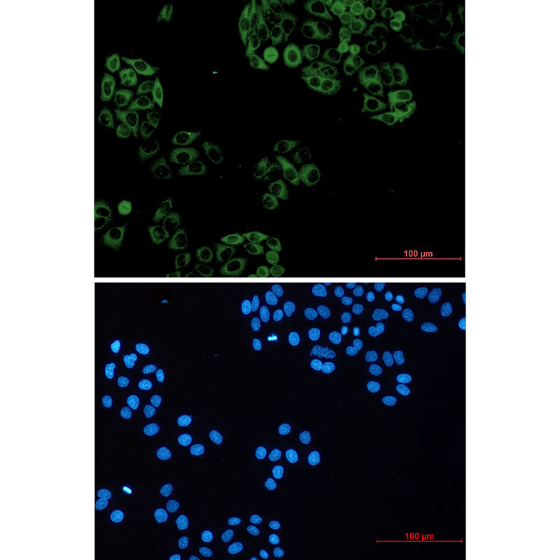 GNAI2 Rabbit mAb ABZ3306