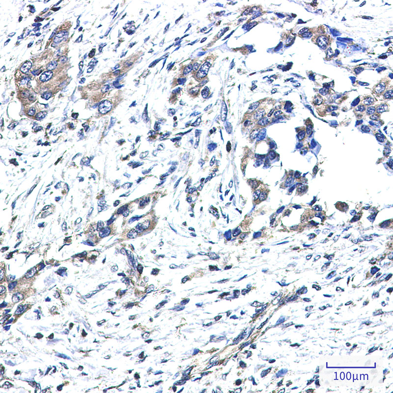 GNAI2 Rabbit mAb ABZ3306