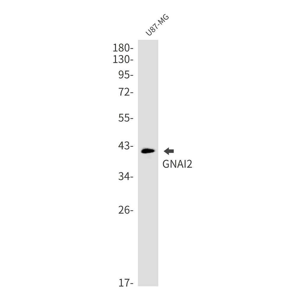 GNAI2 Rabbit mAb ABZ3306