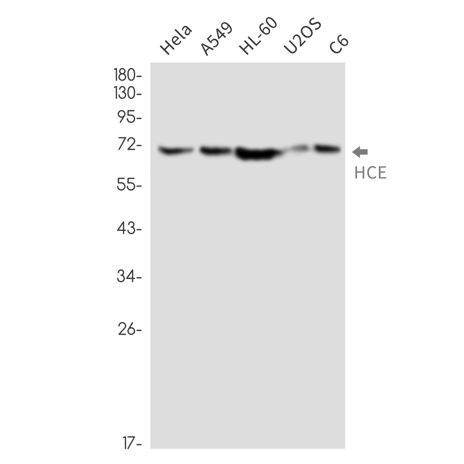 HCE Rabbit mAb ABZ3307