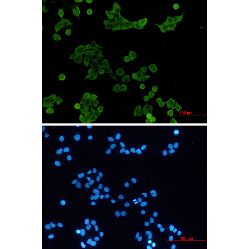 HCK Rabbit mAb ABZ3308
