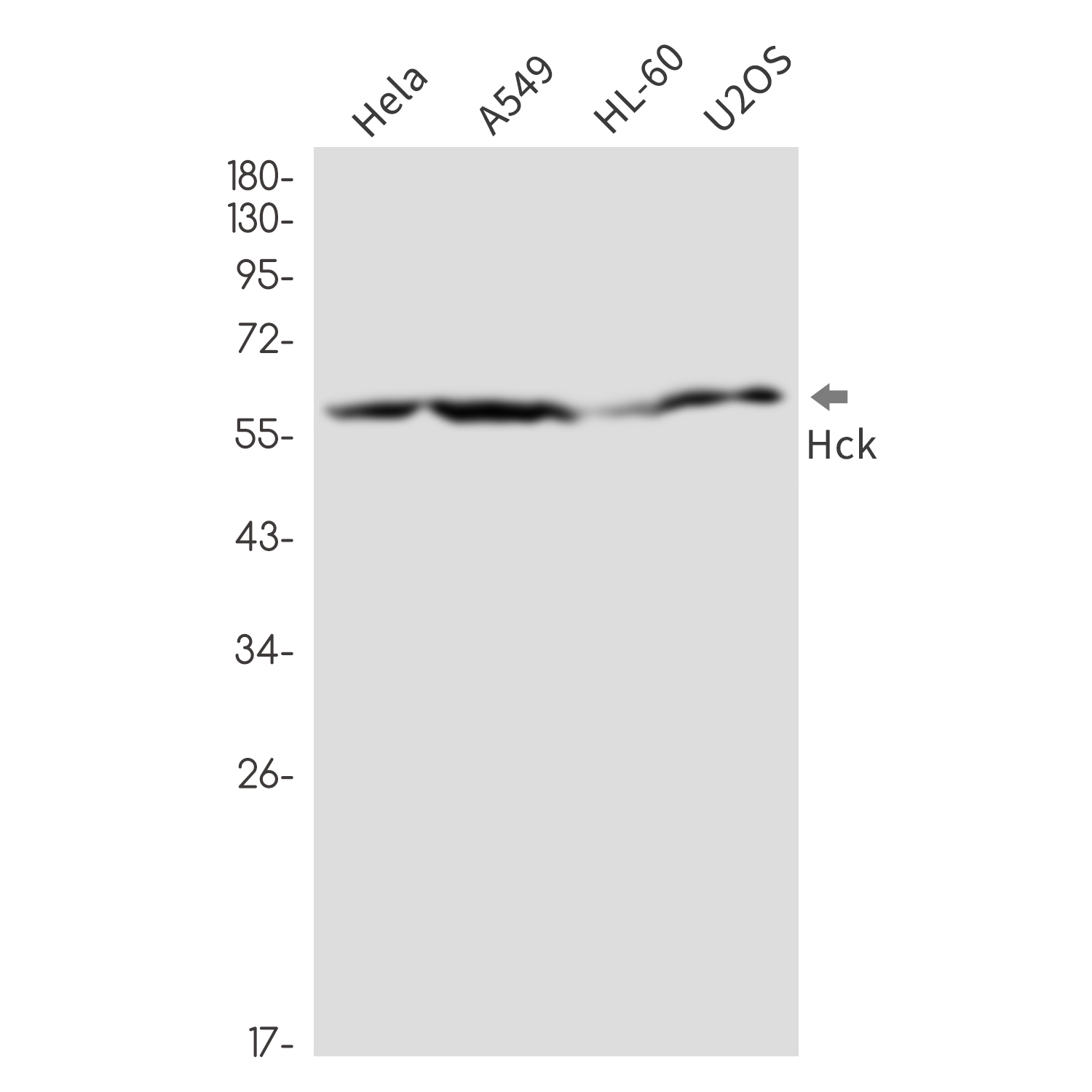 HCK Rabbit mAb ABZ3308