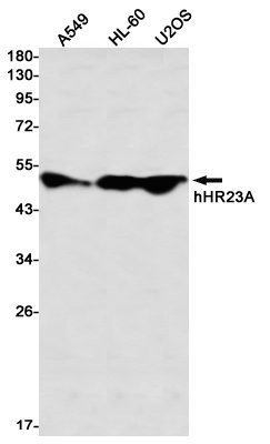 hHR23A Rabbit mAb ABZ3309