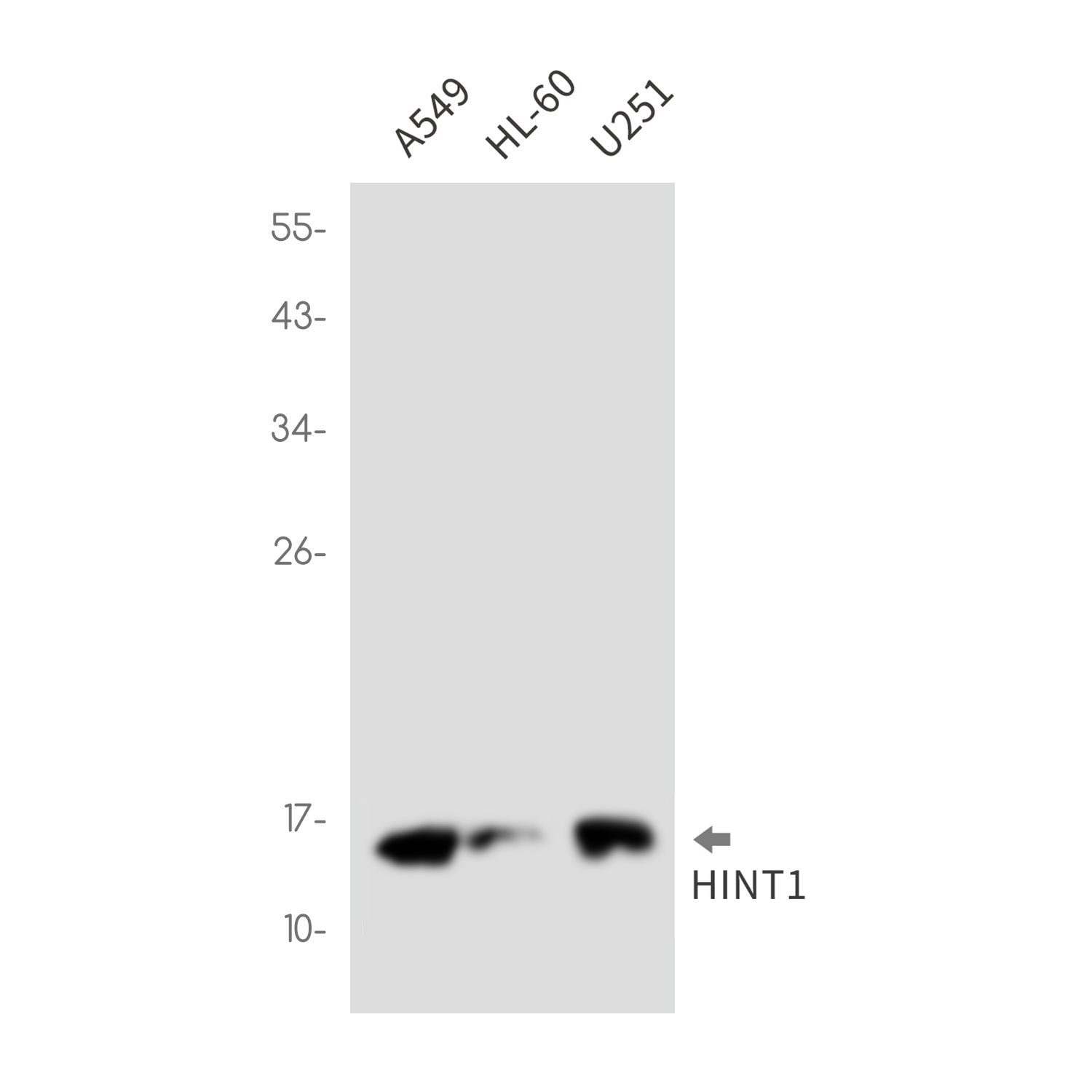 HINT1 Rabbit mAb ABZ3310