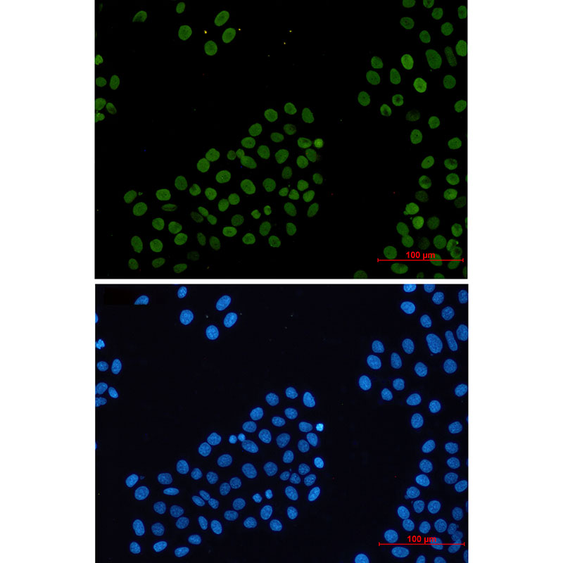 Histone H2A.X Rabbit mAb ABZ3311