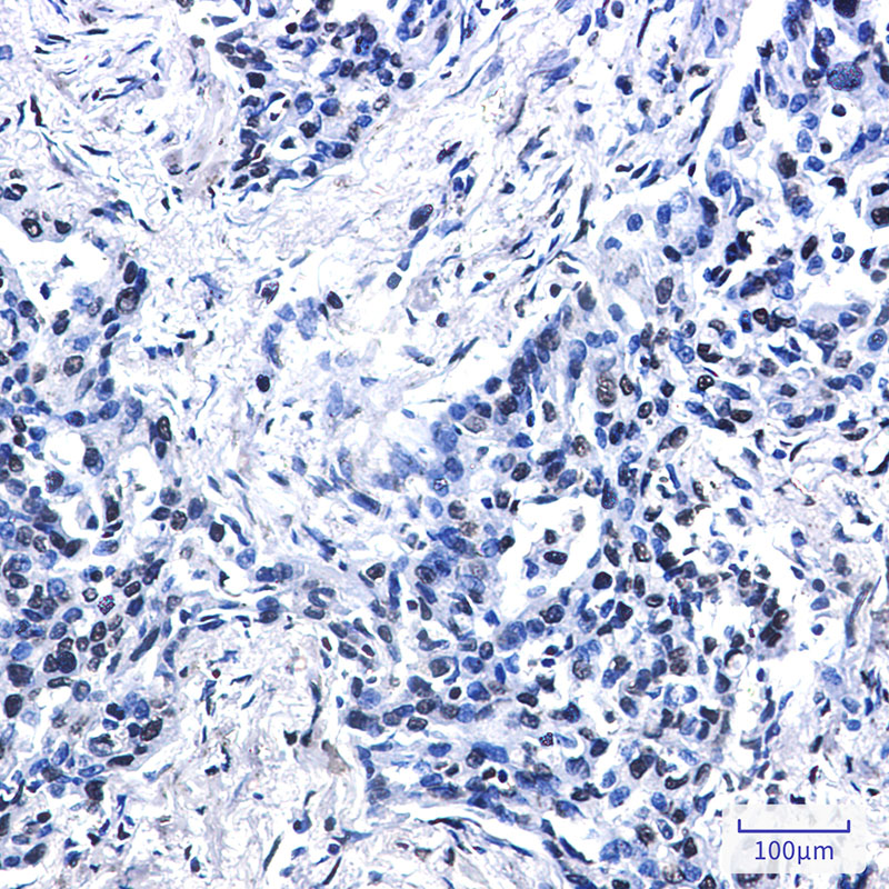 Histone H2A.X Rabbit mAb ABZ3311