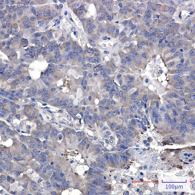 Hsp90 beta Rabbit mAb ABZ3313