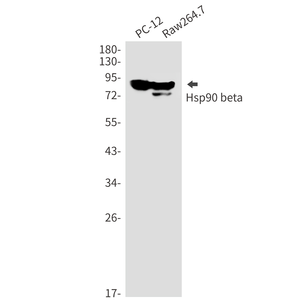 Hsp90 beta Rabbit mAb ABZ3313