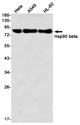 Hsp90 beta Rabbit mAb ABZ3313