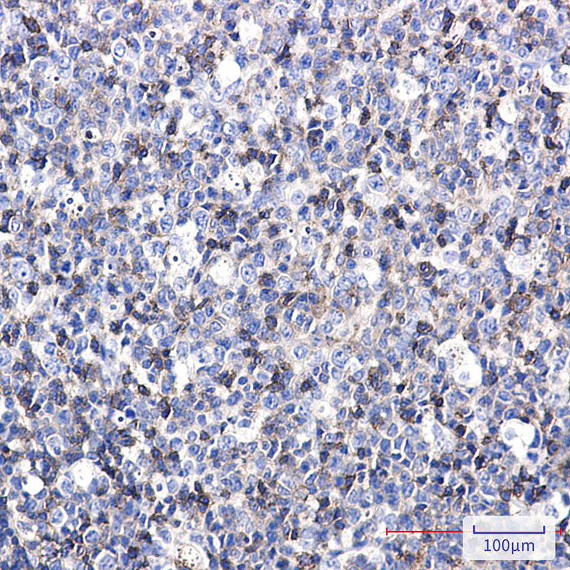 ICAM3 Rabbit mAb ABZ3314