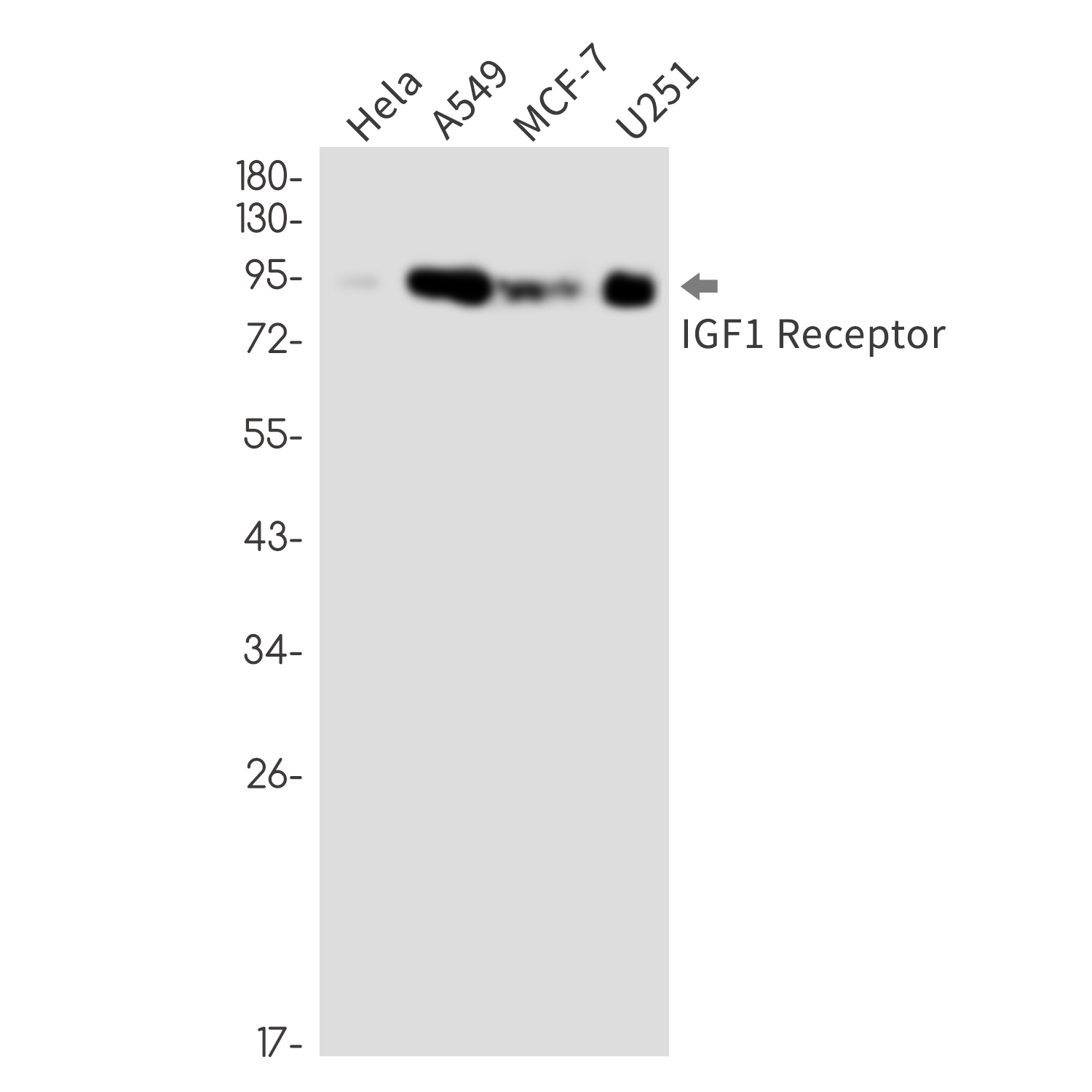 IGF1 Receptor Rabbit mAb ABZ3315