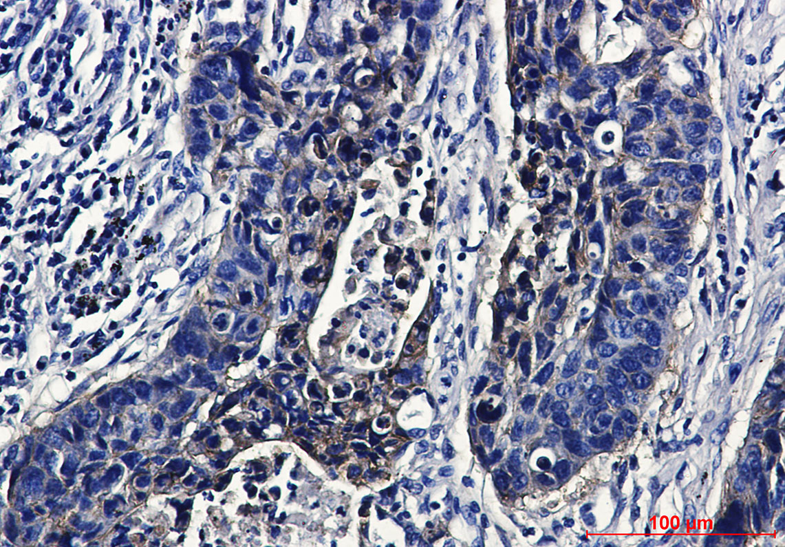 IGF1 Receptor Rabbit mAb ABZ3316