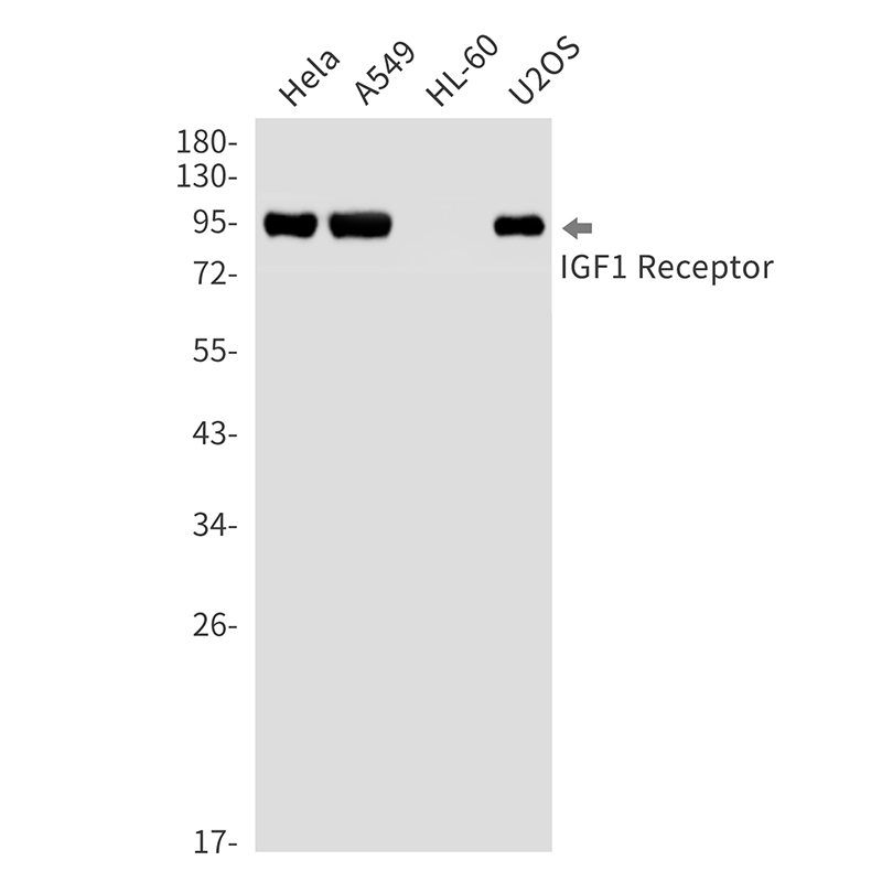IGF1 Receptor Rabbit mAb ABZ3316