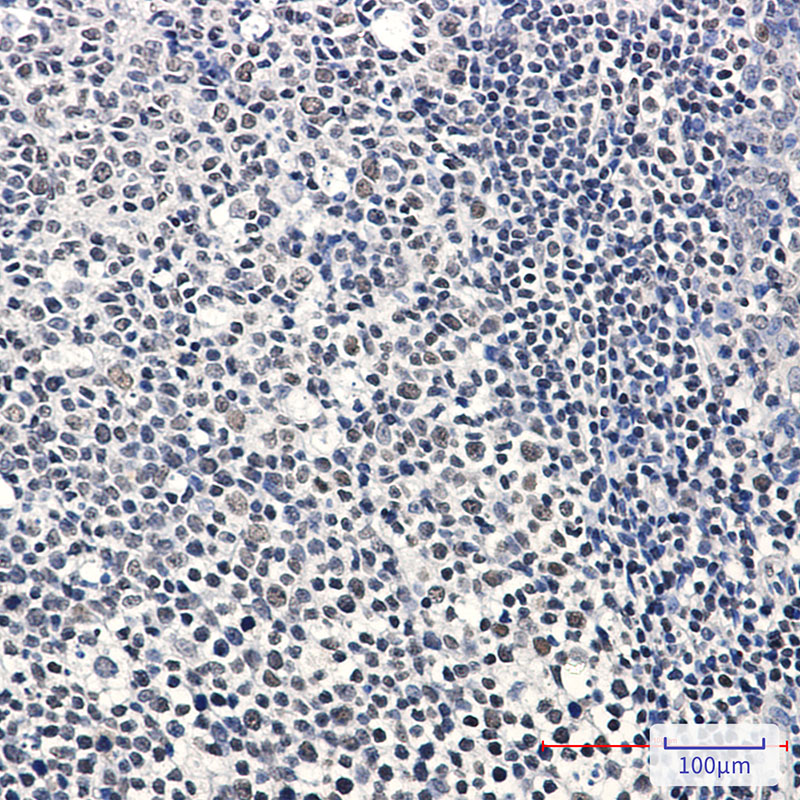 IKZF3 Rabbit mAb ABZ3318