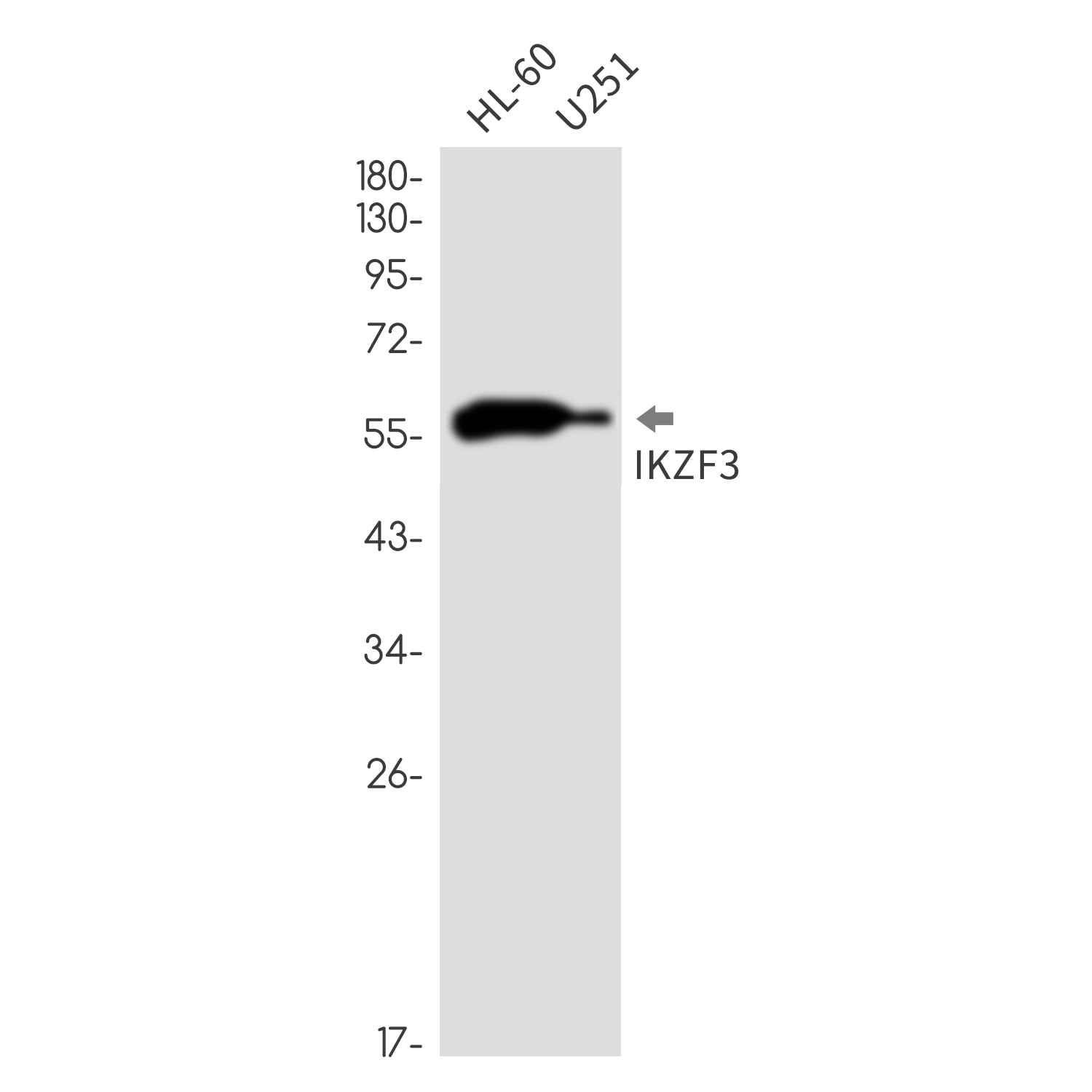 IKZF3 Rabbit mAb ABZ3318