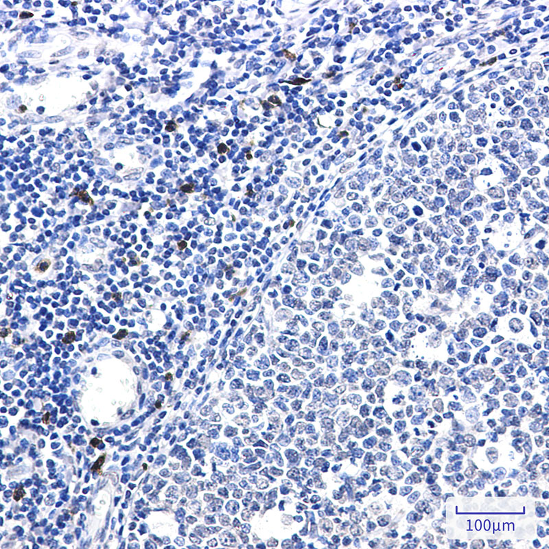 IL-26 Rabbit mAb ABZ3319