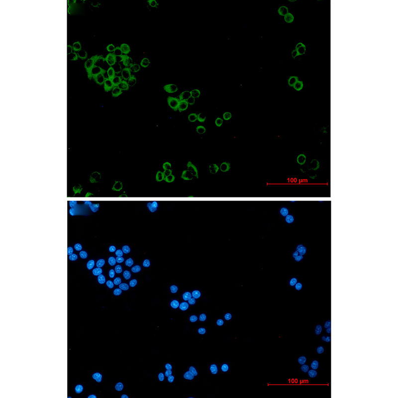 IMPDH2 Rabbit mAb ABZ3320
