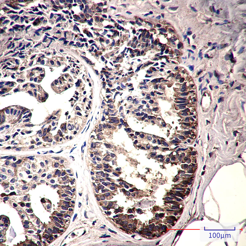 IMPDH2 Rabbit mAb ABZ3320