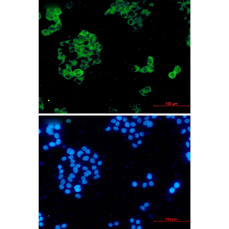 Insulin degrading enzyme Rabbit mAb ABZ3321