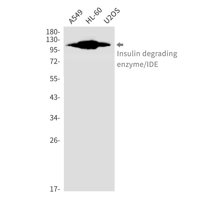 Insulin degrading enzyme Rabbit mAb ABZ3321