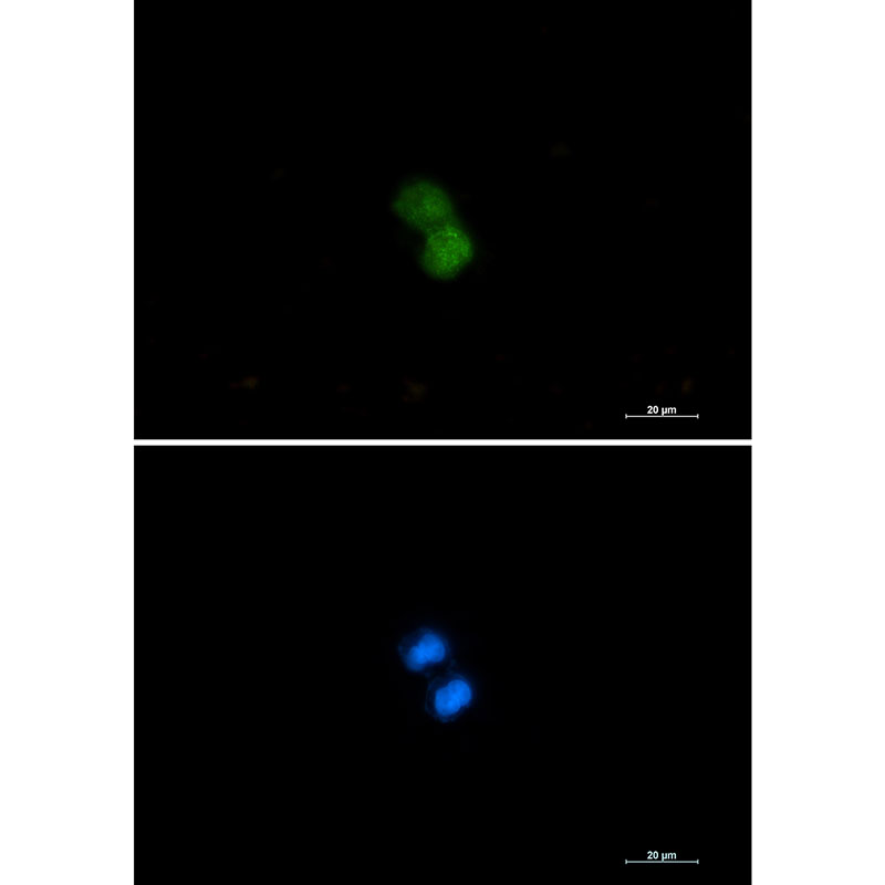 KAT7 Rabbit mAb ABZ3322