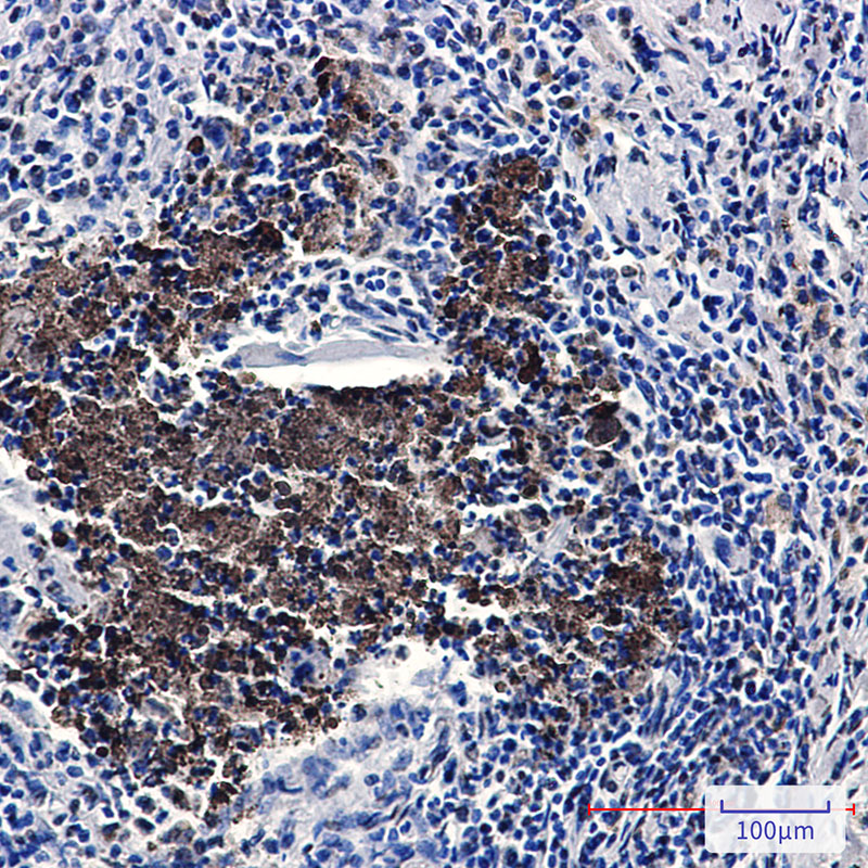 KAT7 Rabbit mAb ABZ3322