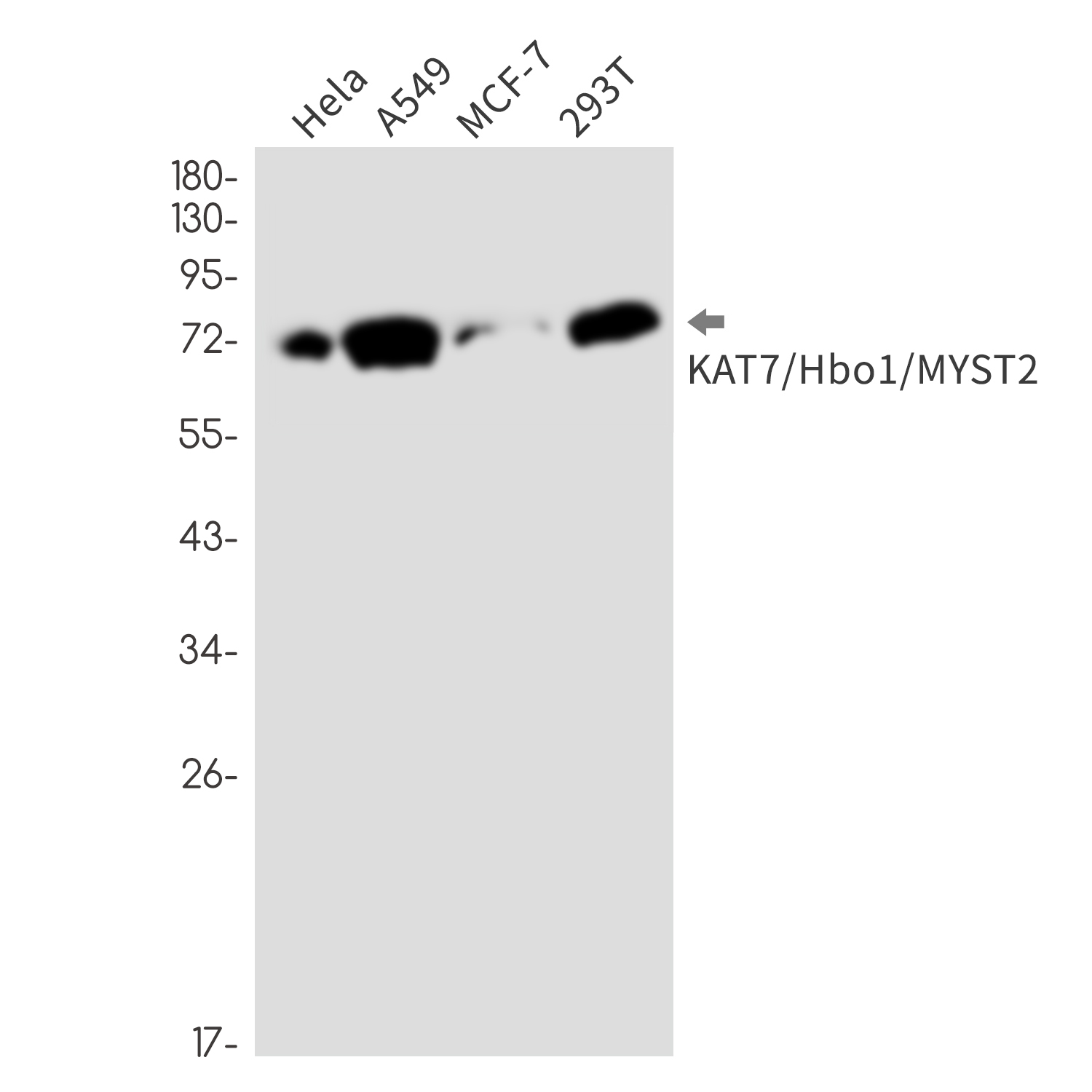 KAT7 Rabbit mAb ABZ3322
