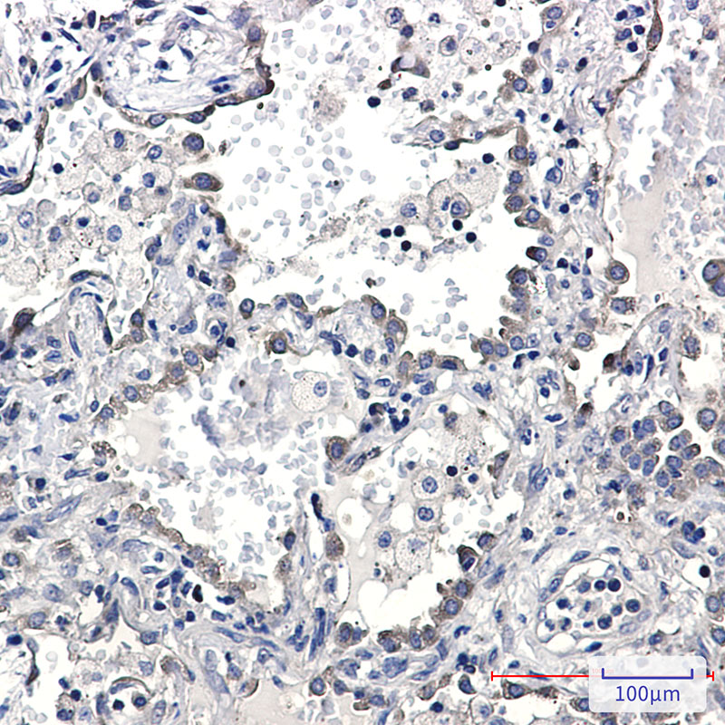 KIFAP3 Rabbit mAb ABZ3323
