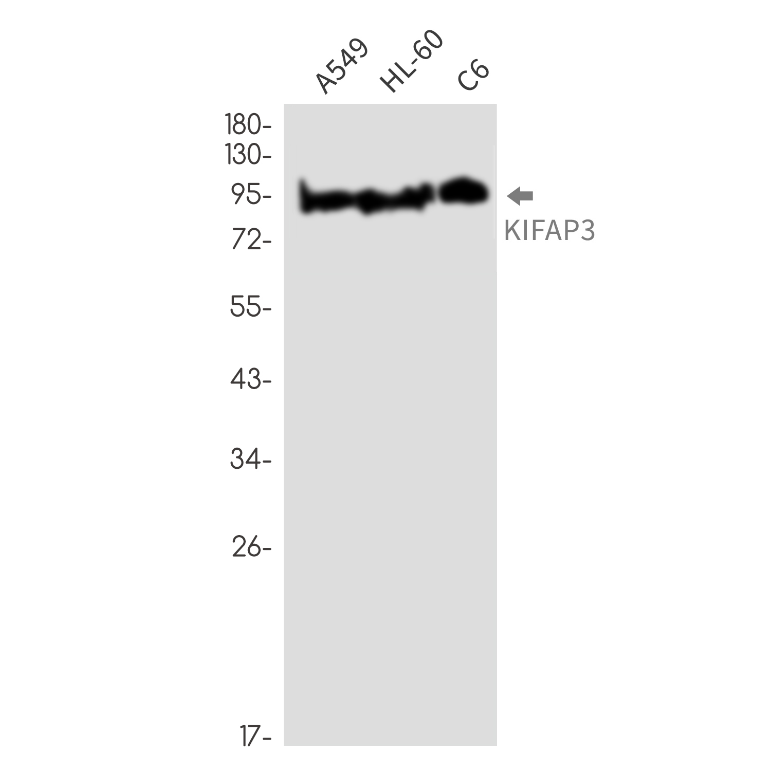 KIFAP3 Rabbit mAb ABZ3323