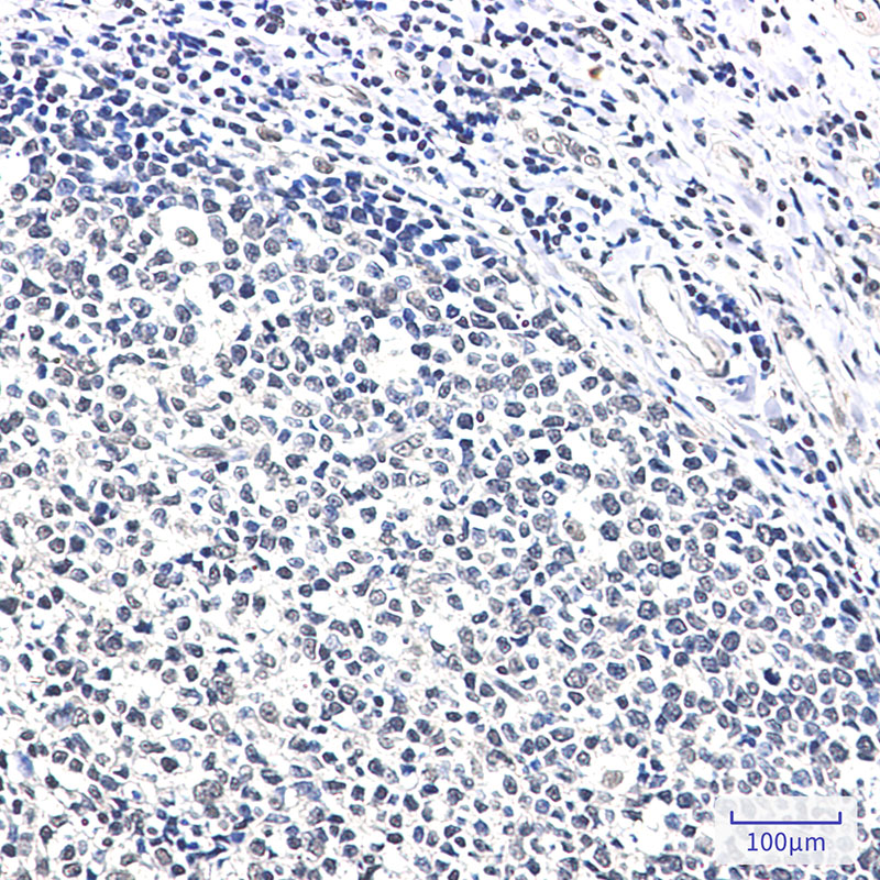 Ku70 Rabbit mAb ABZ3324