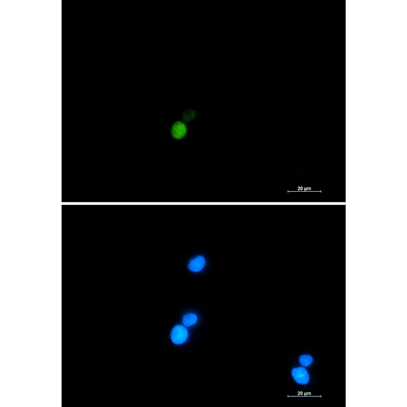Ku70 Rabbit mAb ABZ3325