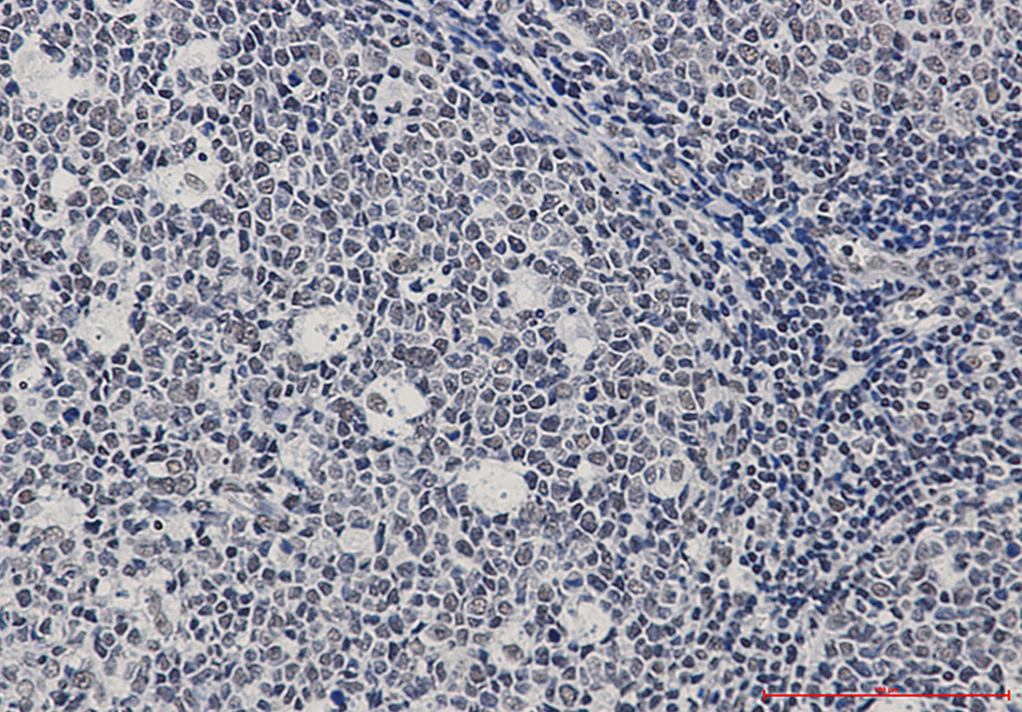 Ku70 Rabbit mAb ABZ3325