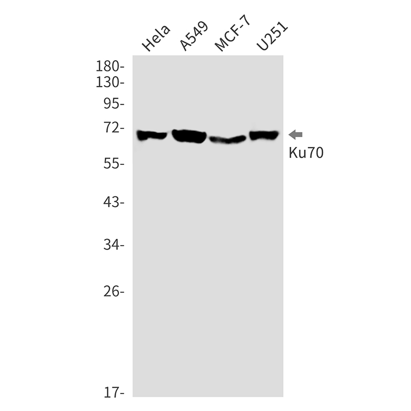 Ku70 Rabbit mAb ABZ3325