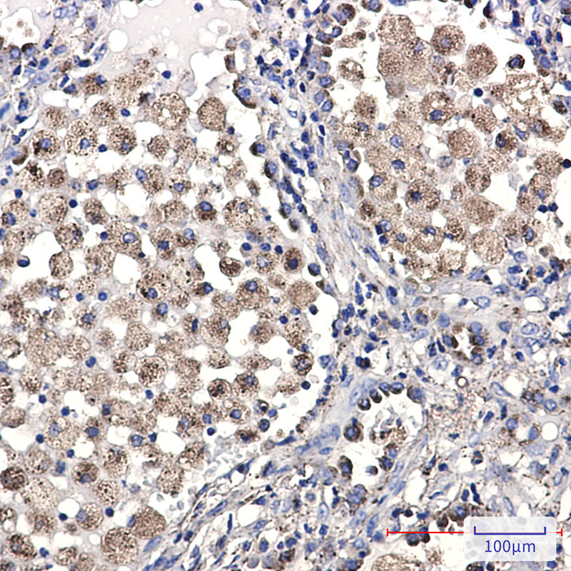 LAMP2 Rabbit mAb ABZ3326