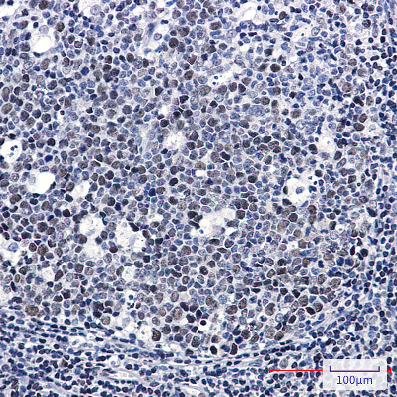 LIG1 Rabbit mAb ABZ3327