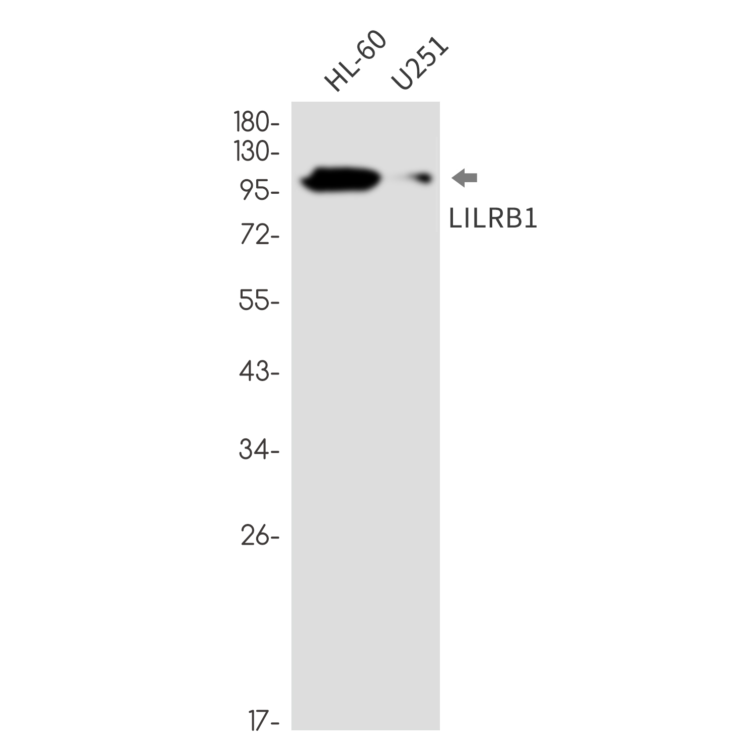 LILRB1 Rabbit mAb ABZ3328