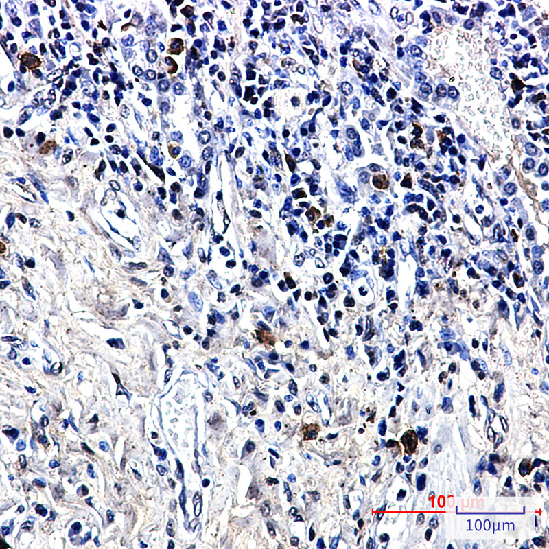 LTK Rabbit mAb ABZ3331