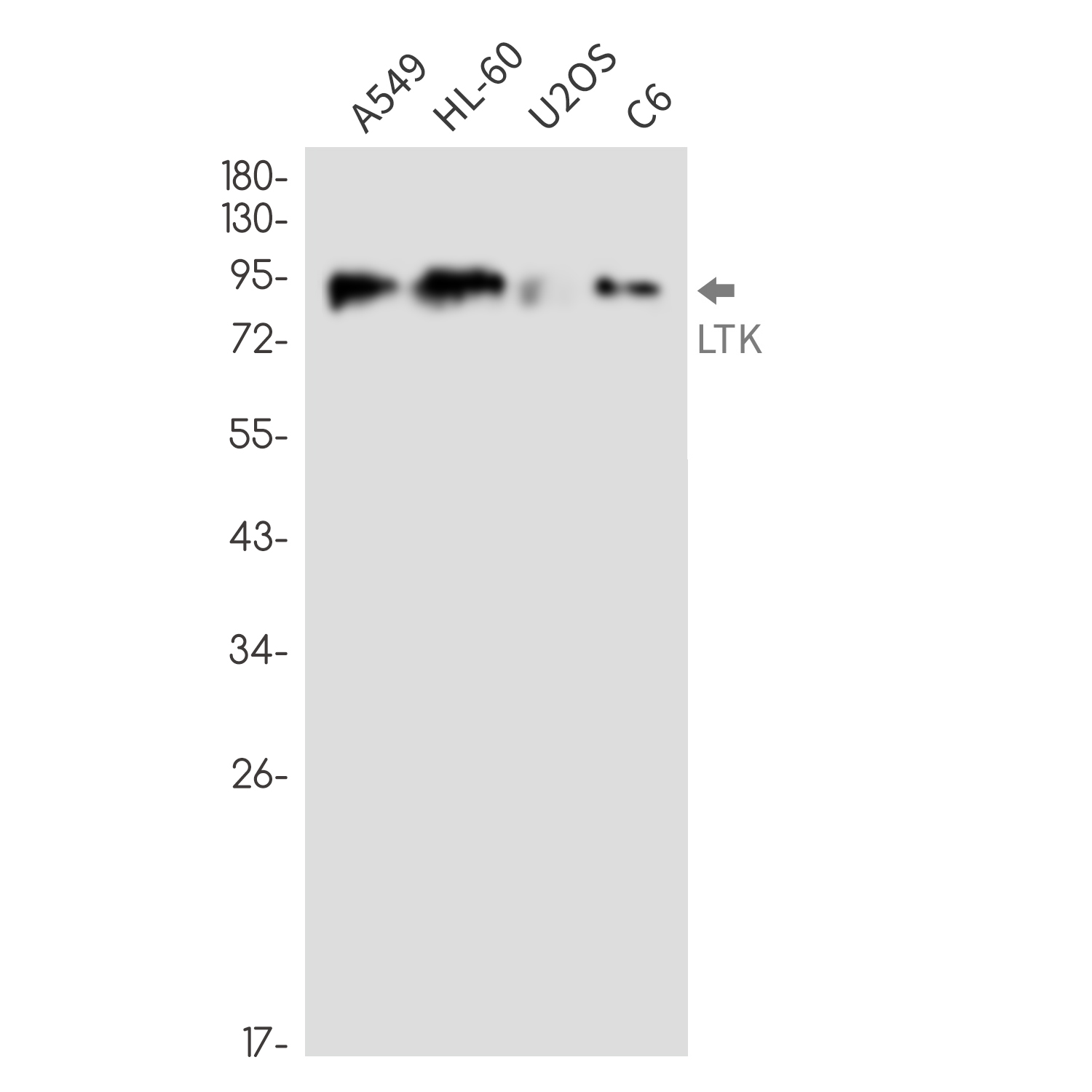 LTK Rabbit mAb ABZ3331