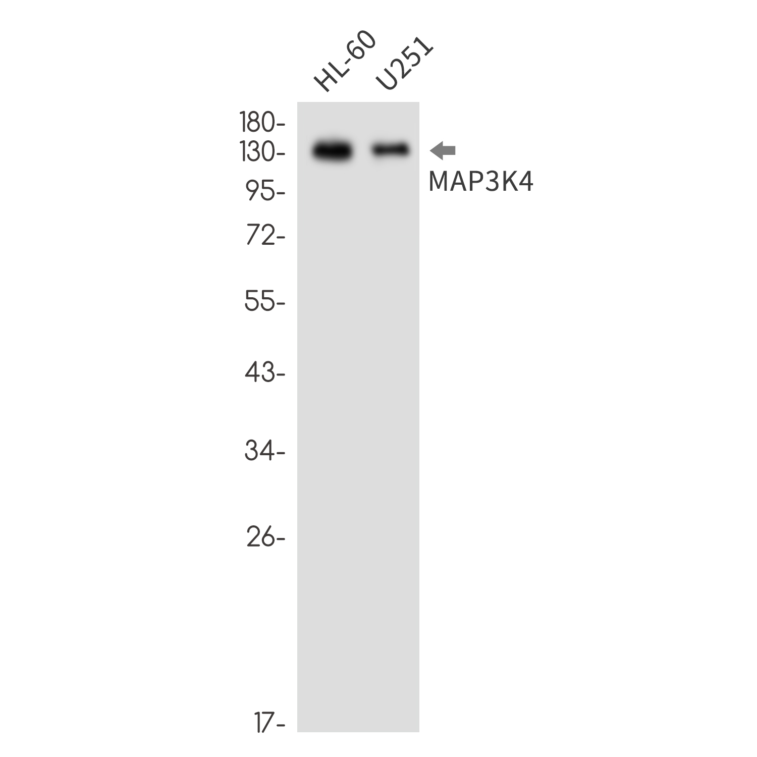 MAP3K4 Rabbit mAb ABZ3332