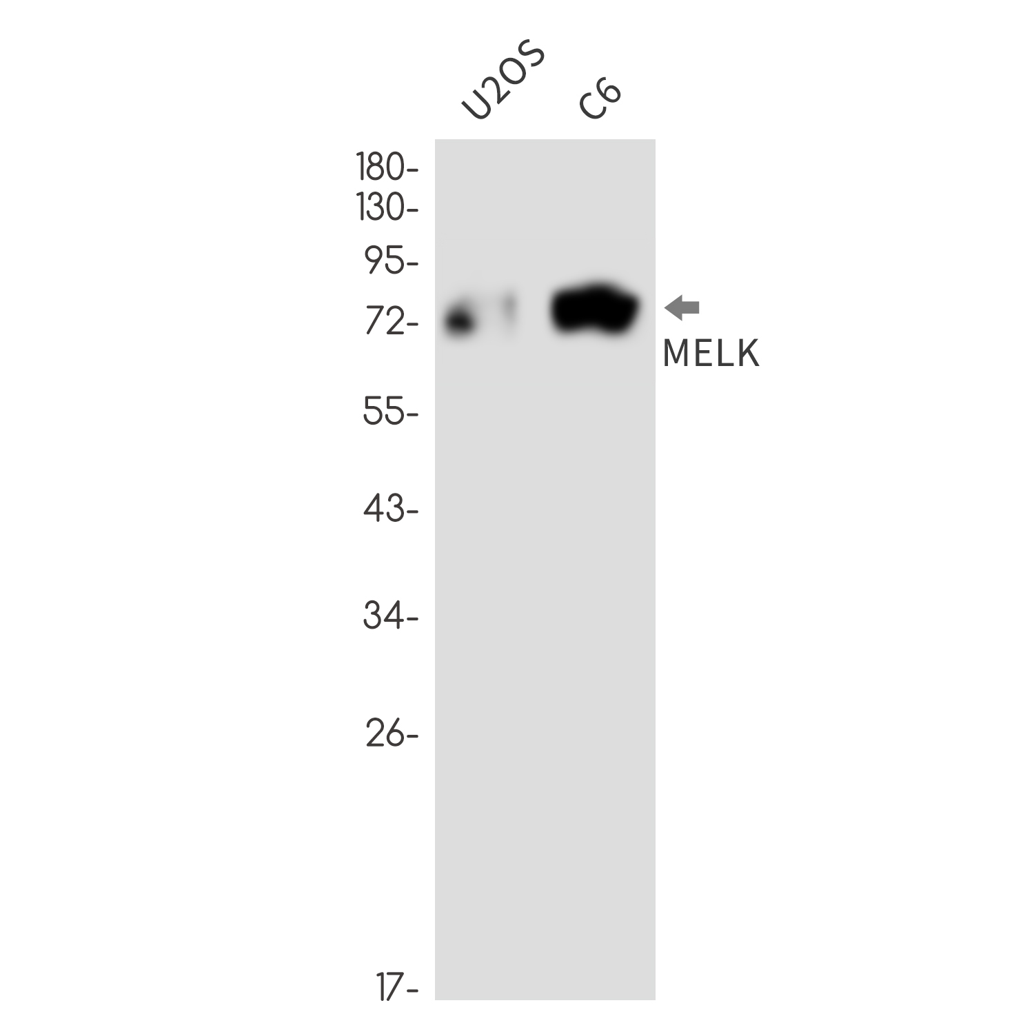 MELK Rabbit mAb ABZ3334
