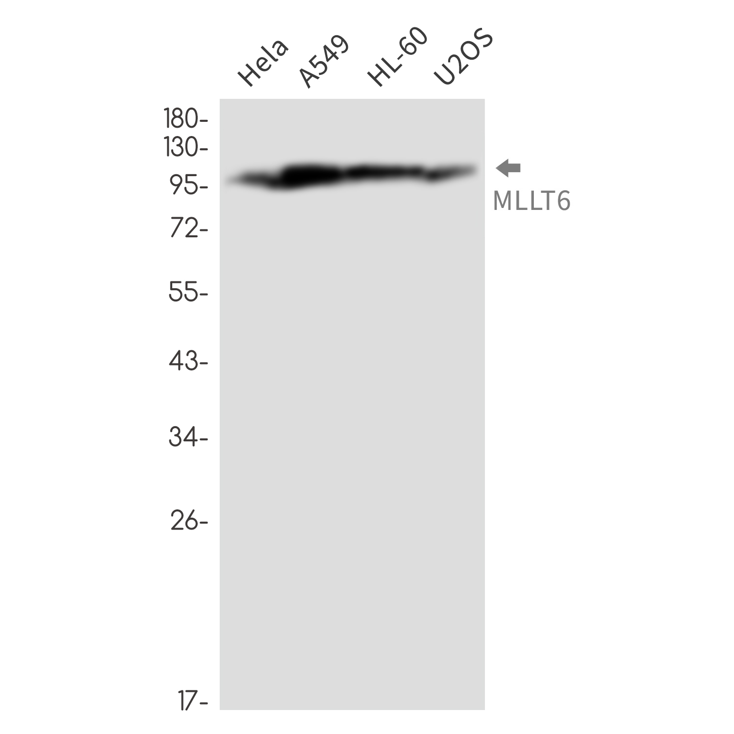 MLLT6 Rabbit mAb ABZ3335